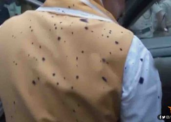 मुँह काला हुआ चौबे जी का और रूठ गई है रंजीता रंजन