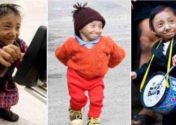 नहीं रहे दुनिया के सबसे छोटे व्यक्ति, 27 वर्ष की आयू में हुआ निधन