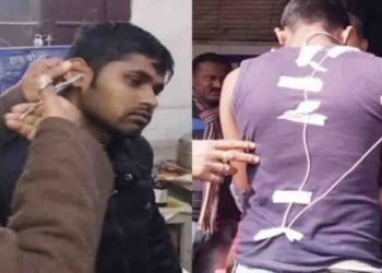 परीक्षा में मुन्ना भाई बनना, छात्र को पड़ गया मंहगा : कान में अटका ब्लूटूथ, ऑपरेशन कर निकाला गया