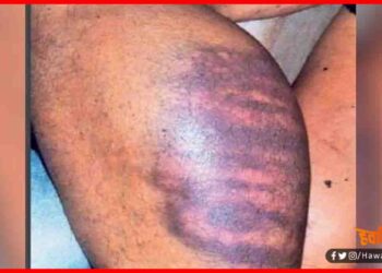 Engineer Died in Police station, Bihpur news, Bhagalpur bihpur news, Bihar news, Bihar hindi news,